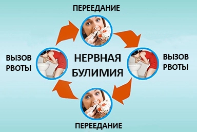 Лечение булимии в Черлаке